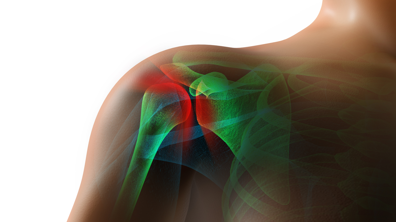 Astym therapy helps in recovery from shoulder surgery
