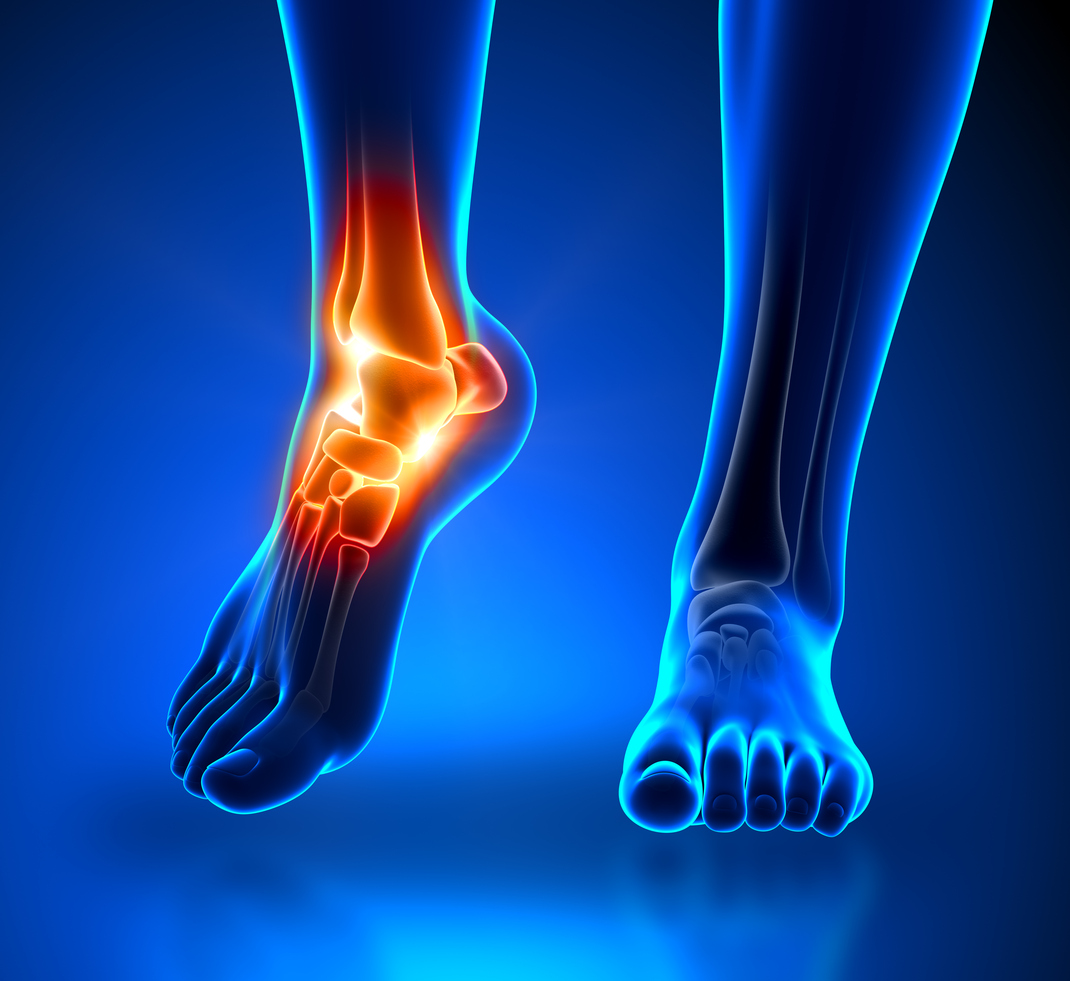 Astym therapy relieves foot pain
